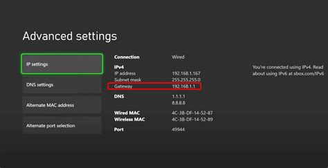 dhcp settings for xbox x